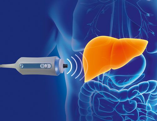 FibroScan® Services